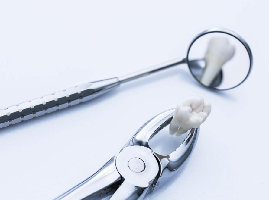 wisdom tooth removal